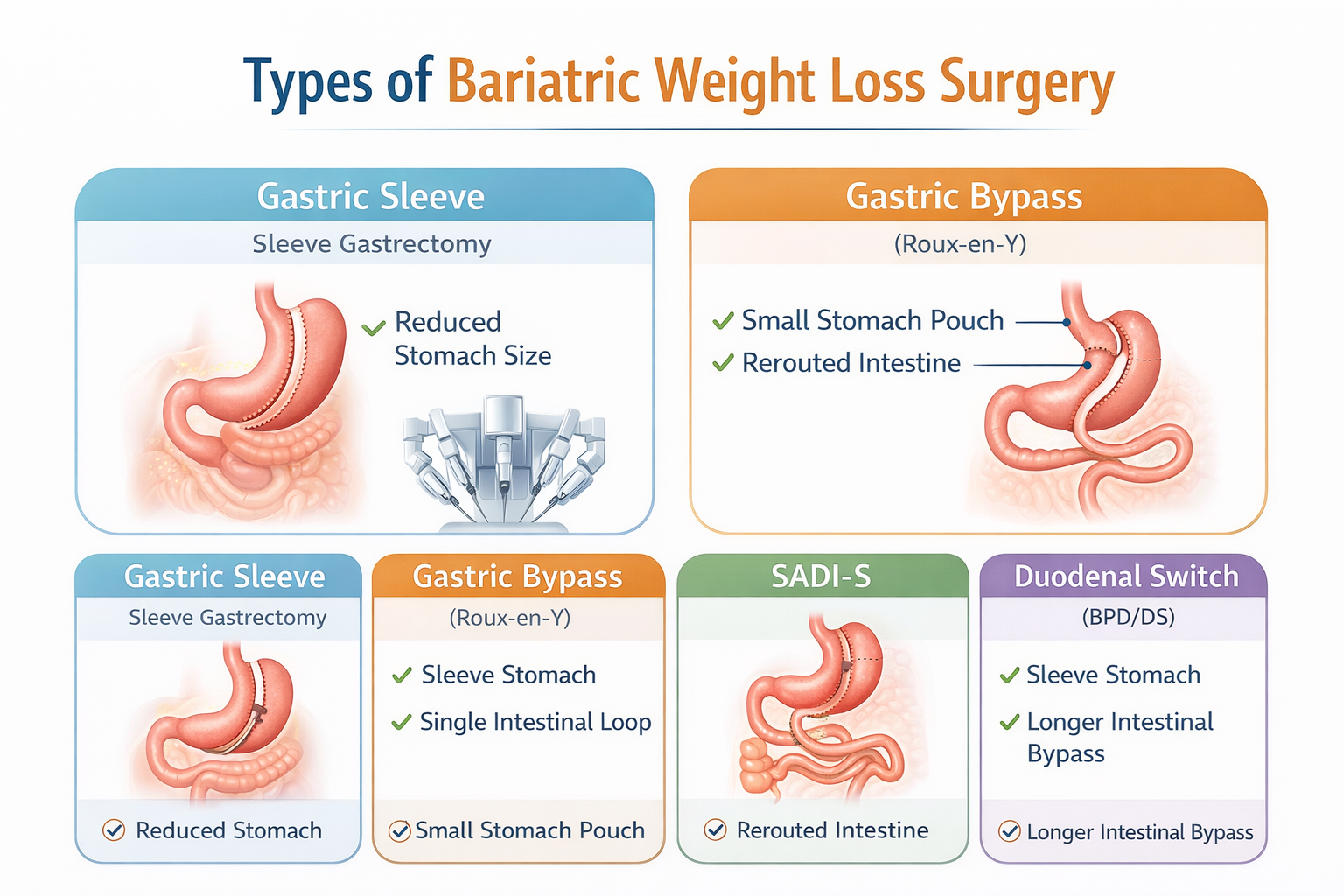 Types of Bariatric Weight Loss Surgery