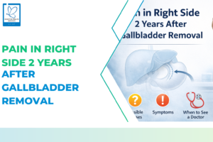 After Gallbladder Removal