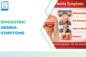 Epigastric Hernia