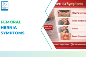 Femoral Hernia