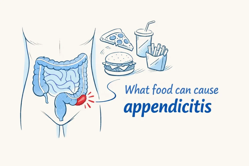 What Food Can Cause Appendicitis?