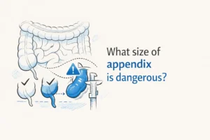 What size of appendix is dangerous