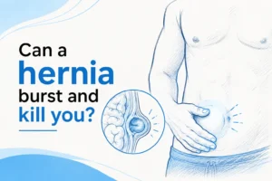 Can a hernia burst and kill you.
