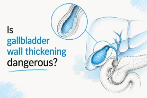 Is Gallbladder Wall Thickening Dangerous