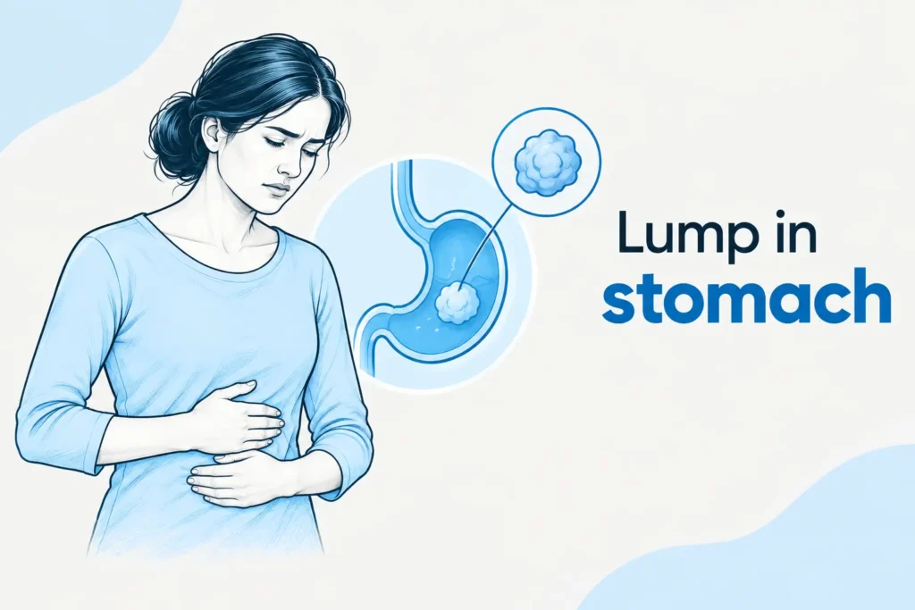 Lump in stomach